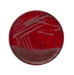 Thermo Scientific™ Columbia Agar with Sheep Blood Medium