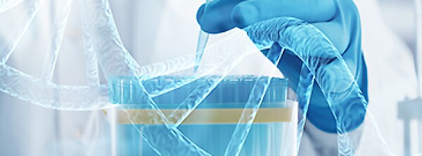 Labcon Eclipse Pipette Tips