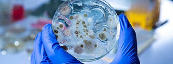 Labcon Eclipse Pipette Tips