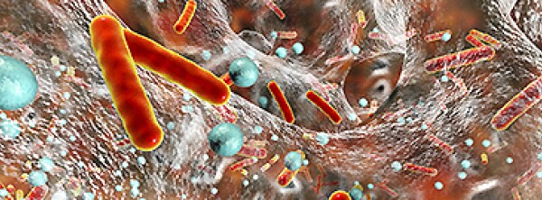 Melford Top Category 2