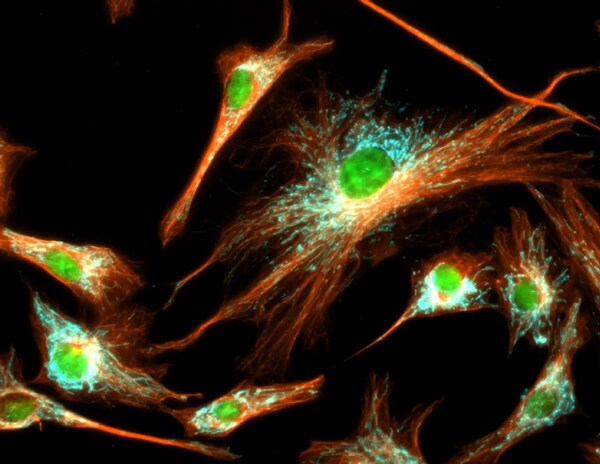 Immunofluorescent analysis of tubulin in BPAE cells with mitochondria (ATP synthase, cyan), tubulin (orange), and nuclei (green) overlays