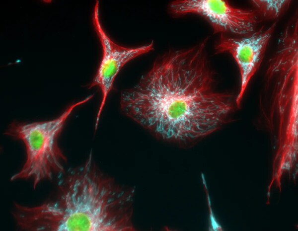 Immunofluorescent analysis of tubulin in BPAE cells with mitochondria (ATP synthase, cyan), tubulin (red) and nuclei (green) overlays